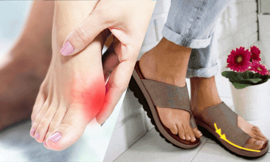 The Best Shoes to Wear if You Have Bunions, According to Podiatrists